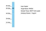 PAPD5 Polyclonal Antibody