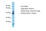 POLR1C Polyclonal Antibody