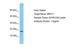 MPV17 Polyclonal Antibody