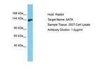 AATK Antibody in Western Blot (WB)