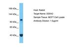 DDX42 Polyclonal Antibody