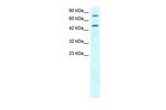 RGS9 Antibody in Western Blot (WB)