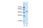 CHRNA9 Polyclonal Antibody