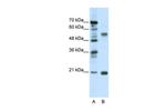 CHRNB3 Polyclonal Antibody