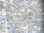 TAL1 Polyclonal Antibody