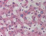 ATF5 Antibody in Immunohistochemistry (IHC)