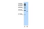 ATF5 Antibody in Western Blot (WB)