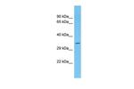 ATF5 Antibody in Western Blot (WB)