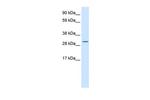 ATF5 Antibody in Western Blot (WB)