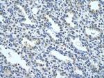 NR2F2 Antibody in Immunohistochemistry (Paraffin) (IHC (P))