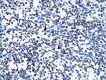 GCM1 Polyclonal Antibody