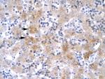 LIM1 Polyclonal Antibody