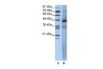 SRF Polyclonal Antibody