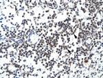 GABPB2 Polyclonal Antibody