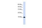 ID1 Polyclonal Antibody