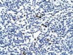 TAL1 Polyclonal Antibody