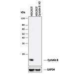 Cystatin B Antibody in Western Blot (WB)
