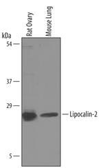 NGAL Polyclonal Antibody