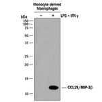 MIP-3 beta Polyclonal Antibody