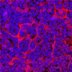 Eotaxin Polyclonal Antibody