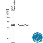 Prostasin Antibody in Western Blot (WB)