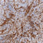 Tenascin X Polyclonal Antibody