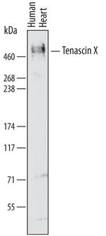 Tenascin X Antibody in Western Blot (WB)