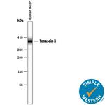 Tenascin X Antibody in Western Blot (WB)