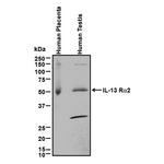 IL13RA2 Antibody in Western Blot (WB)