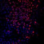 Brachyury Polyclonal Antibody