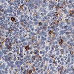 TIM3 Antibody in Immunohistochemistry (Paraffin) (IHC (P))