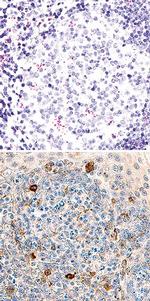 TIM3 Antibody in Immunohistochemistry (Paraffin) (IHC (P))