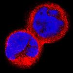 IL15RA Polyclonal Antibody