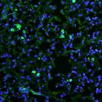 CD206 Polyclonal Antibody