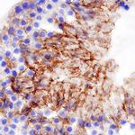 CD206 Antibody in Immunohistochemistry (Frozen) (IHC (F))