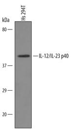 IL-12/IL-23 p40 Polyclonal Antibody