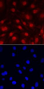 IL-33 Polyclonal Antibody