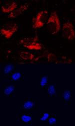 LRIG1 Polyclonal Antibody
