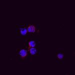CXCL2 Polyclonal Antibody