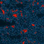 CXCL13 Polyclonal Antibody