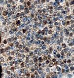 SERPINA9 Polyclonal Antibody