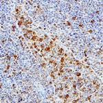 cIAP1 Antibody in Immunohistochemistry (Paraffin) (IHC (P))
