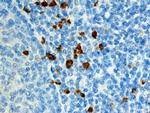 S100A12 Polyclonal Antibody