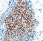 Cathepsin V Polyclonal Antibody