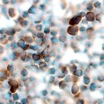 TRAIL Polyclonal Antibody