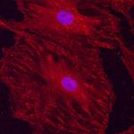 CD51 Antibody in Immunocytochemistry (ICC/IF)