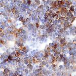 IGFBP-1 Polyclonal Antibody