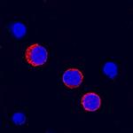 FCGR2B Polyclonal Antibody