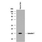 Galectin 7 Antibody in Western Blot (WB)