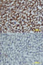 Growth Hormone Receptor Polyclonal Antibody